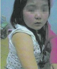 小學(xué)生沒(méi)考100分被老師打 兩個(gè)月不敢上學(xué) 小學(xué)生沒(méi)考100分被老師打 兩個(gè)月不敢上學(xué)