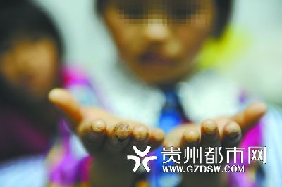 指尖被針扎得傷痕累累。