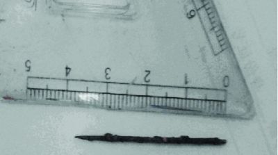 取出的繡花針已發(fā)黑生銹。