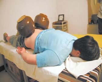 拔泡菜壇子火罐。