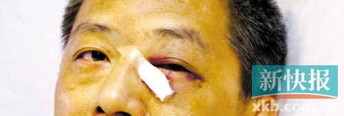 ■這起醫(yī)鬧事件，受傷的遠(yuǎn)遠(yuǎn)不只是熊旭明醫(yī)生的身體。