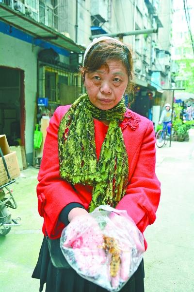 頭部受傷的黃女士展示兩根大魚(yú)刺。