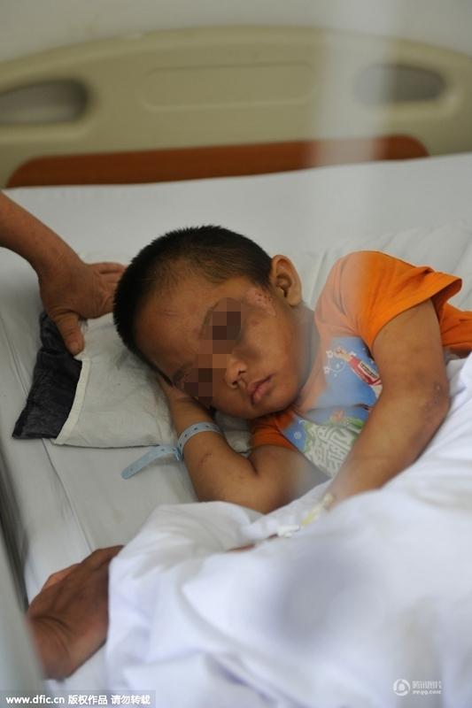 圖為全身傷痕累累的小進(jìn)。