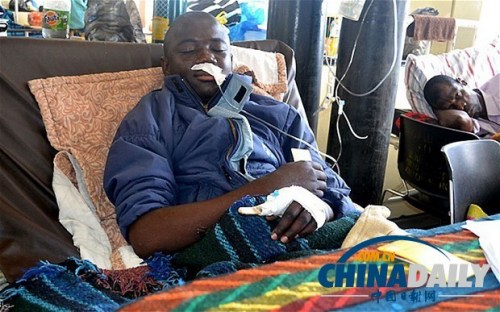 雖然已經(jīng)在醫(yī)院接受了近一個(gè)月的恢復(fù)治療，卡托卡的身體仍然非常虛弱。