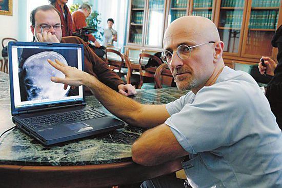 圖為卡納維洛醫(yī)生，不少人認為他的想法非常瘋狂