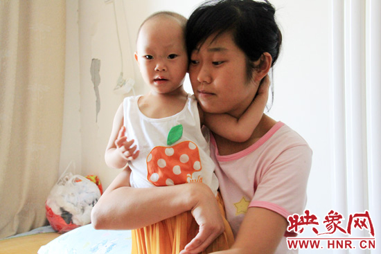 孩子和媽媽在一起，她的右眼已經(jīng)失明。