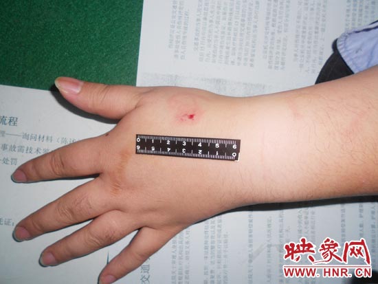 為幫助無證駕駛的朋友逃避處罰，新鄉(xiāng)的王某竟對執(zhí)勤民警大打出手，還將一名民警的手臂咬傷