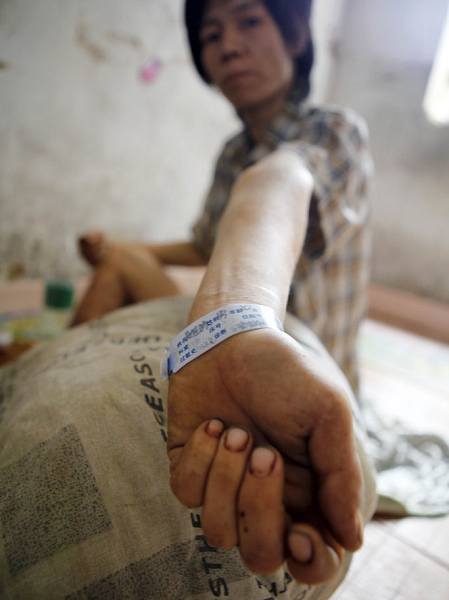 真實記錄一個吸毒者生命最后19天 真實記錄一個吸毒者生命最后19天