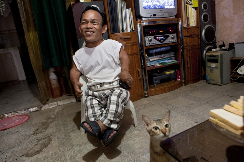 侏儒癥患者的艱辛生活 侏儒癥患者的艱辛生活