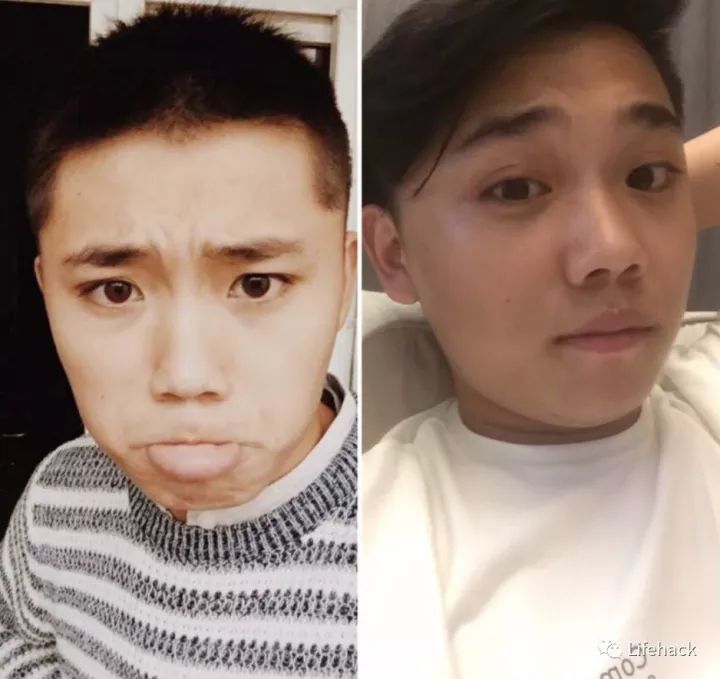 長(zhǎng)胖20斤，臉型怎么變？這些例子看完扎心了！