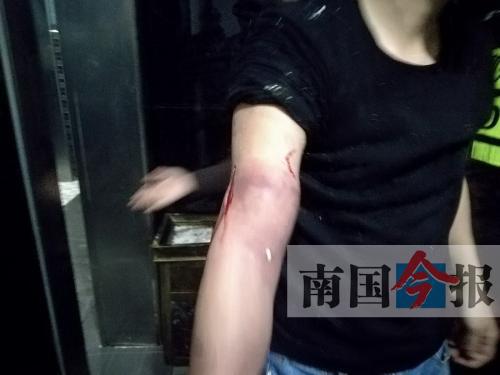 覃先生手臂被卡的部位受傷流血，所幸傷勢無大礙。 通訊員 王建民 攝