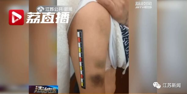 女子未如約離婚嫁給前任 遭對(duì)方拘禁毆打渾身是傷