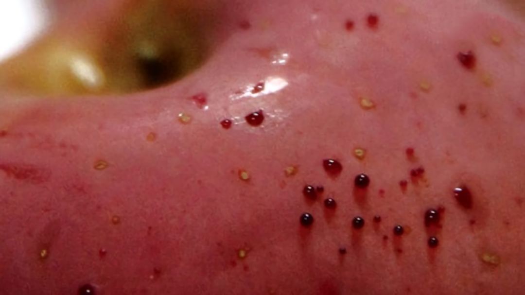 嚇懵！女子用熱水泡蘋果結(jié)果冒出血珠 咋回事？