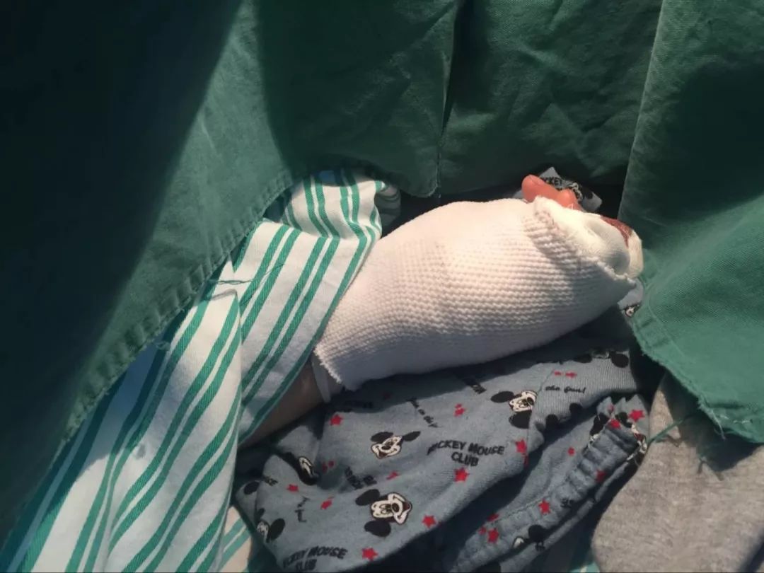 嚇哭！6歲男孩被夾斷手指 罪魁禍首竟是校服