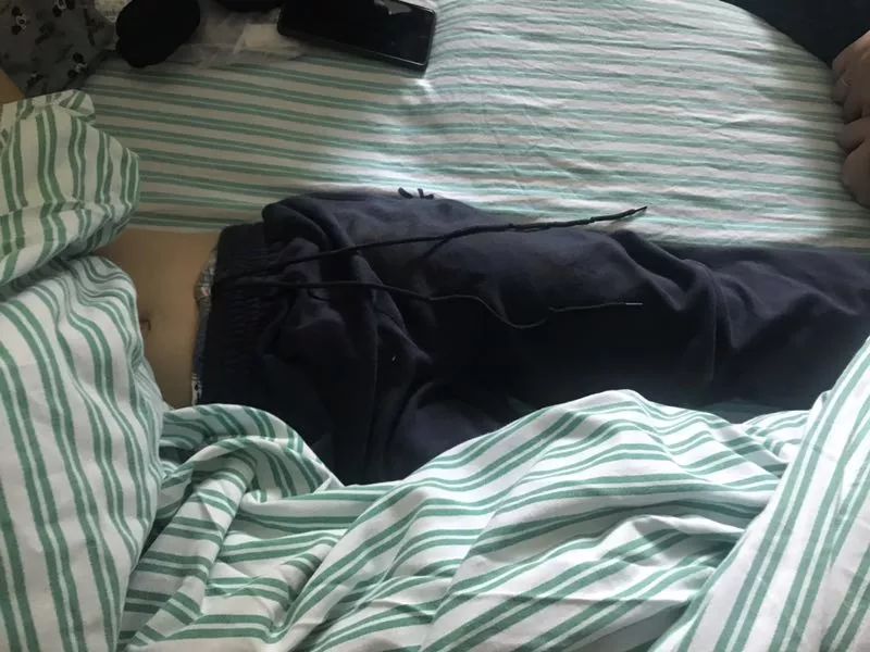 嚇哭！6歲男孩被夾斷手指 罪魁禍首竟是校服