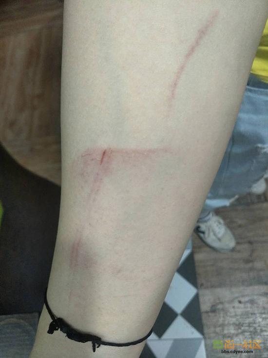 女網(wǎng)友舉報網(wǎng)帖中出示的被打后照片。