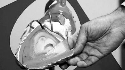 威廉斯領(lǐng)導(dǎo)的研究團(tuán)隊(duì)已經(jīng)利用人體脂肪干細(xì)胞，成功3D打印出心臟血管和心臟瓣膜，待一顆心臟的所有部件打