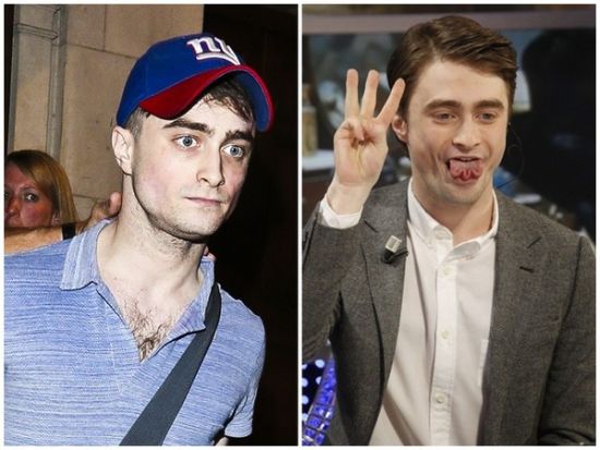 丹尼爾日前被拍到骨瘦如柴，不似2月份健康