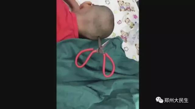 剪刀插入6歲女孩頭部 圖片讓人心驚膽戰(zhàn) 剪刀插入6歲女孩頭部 圖片讓人心驚膽戰(zhàn)