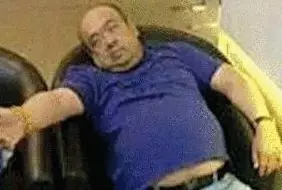 網(wǎng)傳金正男中毒后的照片。