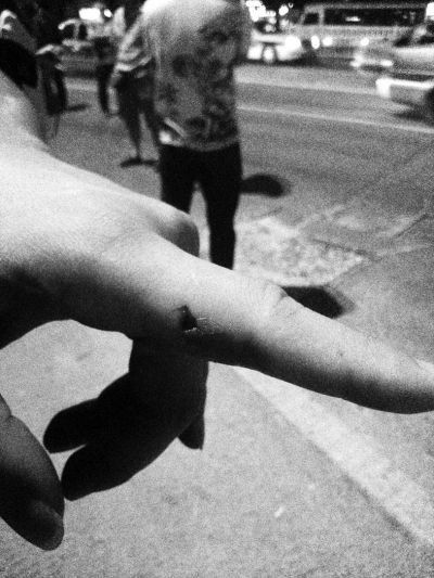 民警食指被咬傷。