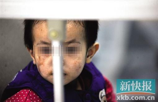 去年3月就能出院的小華(化名),目前還在廣州市婦兒醫(yī)療中心的PICU里住著。新快報(bào)記者 孫毅/攝