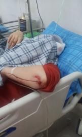 砸窗當(dāng)事人胡女士在醫(yī)院接受治療。