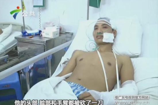 另一名傷者頭部、臉部和手臂都被砍了一刀。(視頻截圖)