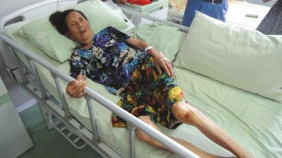 躺在病床上的受傷者李獻瑞