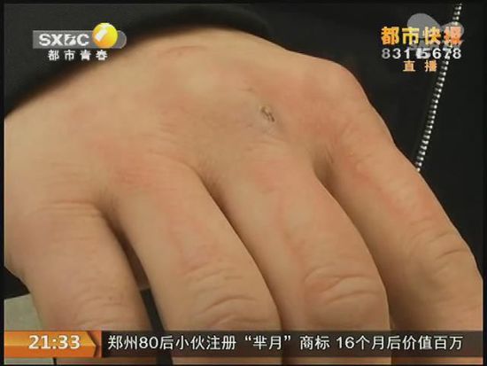 說到這足療拔罐，估計(jì)大伙都不陌生，但是想起4號晚上的拔罐的經(jīng)歷，呂先生現(xiàn)在想起來，還心有余悸。