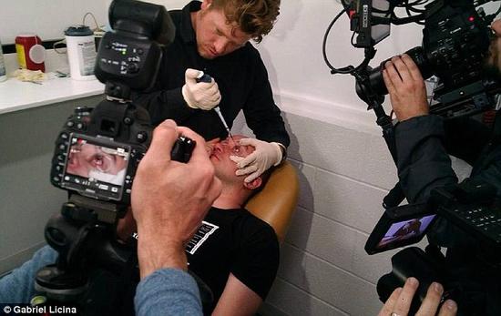 該實驗是由加州一支名為“生物駭客”的實驗團隊開展的。他們使用了一種名為二氫卟吩e6（Ce6）的物質(zhì)的溶液。Ce6常見于深海魚體內(nèi)，有光敏特性，通常用于癌癥治療研究中。研究團隊將Ce6與胰島素和鹽水混合起來，得到一種溶液，可以在低光照條件下提高人類的視力。