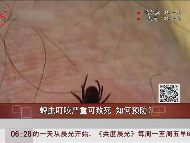 蜱蟲(chóng)叮咬嚴(yán)重可致死如何預(yù)防？