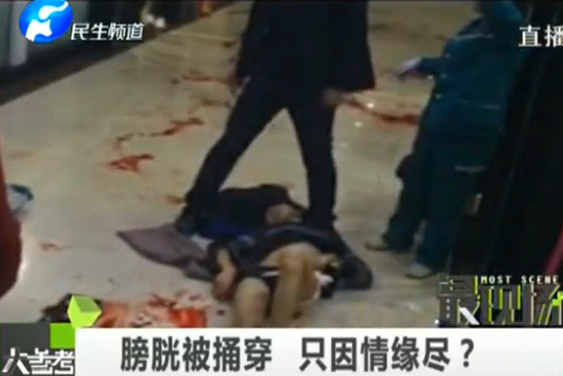 膀胱被捅穿 只因情緣盡？